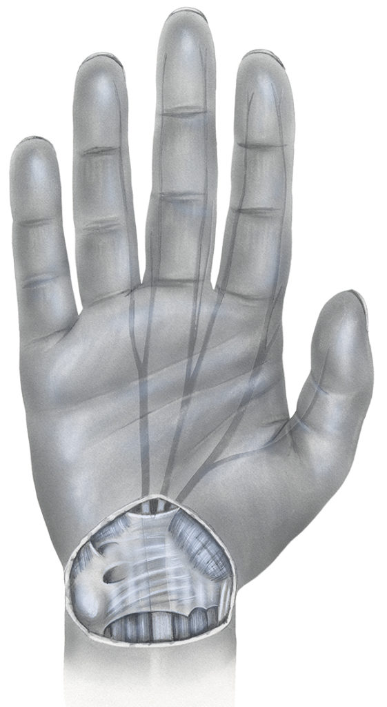 Have You Tried Acupuncture for Carpal Tunnel Syndrome?Wholeself Acupuncture